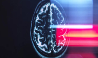 Trí tuệ nhân tạo giúp tầm soát Alzheimer