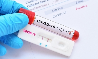 Bất thường trong vay, mượn hơn 1.000 tỷ đồng kit test Covid-19
