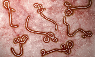 WHO công bố dịch Ebola (sốt xuất huyết Ebola) tại Uganda
