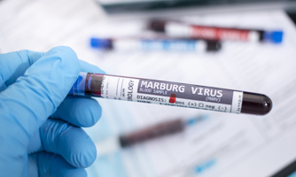 Virus Marburg: Cảnh báo nguy cơ dịch chồng dịch