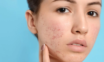 Mỹ phẩm hay thực phẩm chức năng giả đều gây hại cho sức khỏe