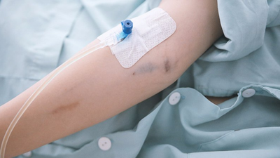 Tỷ lệ mắc sốt xuất huyết ở Hà Nội tăng gấp 4,5 lần