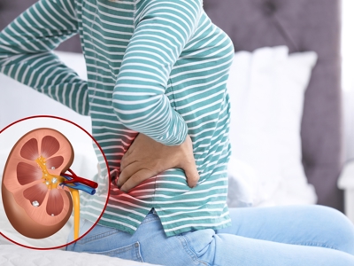 Bệnh thận trẻ hóa do lối sống và lỗ hổng tầm soát