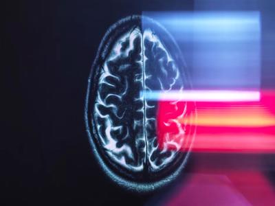 Trí tuệ nhân tạo giúp tầm soát Alzheimer