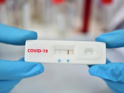 Bộ Y tế yêu cầu doanh nghiệp báo cáo giá bán test xét nghiệm Covid-19 