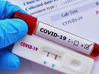 Cơ sở kinh doanh phải niêm yết giá bán test xét nghiệm Covid-19