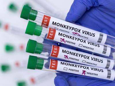 Số ca mắc đậu mùa khỉ tăng gấp 3 sau một tuần, chủng virus thứ hai đang lây lan