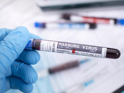 Virus Marburg: Cảnh báo nguy cơ dịch chồng dịch