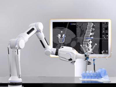 Ứng dụng Robot trong điều trị bệnh lý cột sống