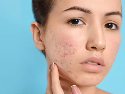 Mỹ phẩm hay thực phẩm chức năng giả đều gây hại cho sức khỏe
