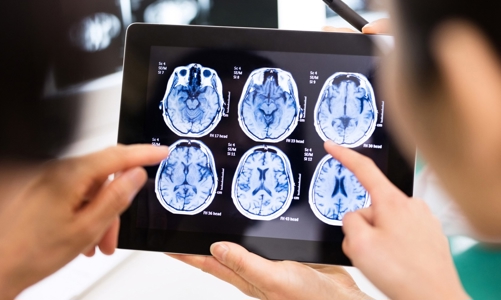 Bệnh viện Việt tiếp cận công nghệ xét nghiệm và chẩn đoán mới