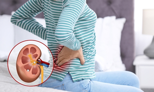 Bệnh thận trẻ hóa do lối sống và lỗ hổng tầm soát