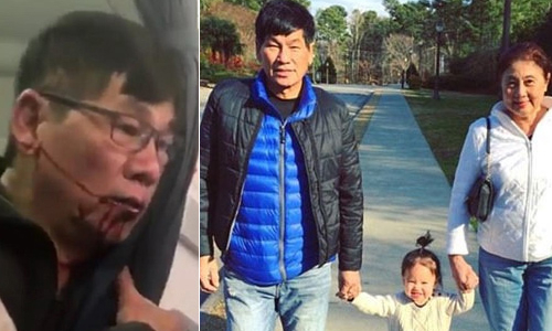 Hành khách bị kéo lê khỏi máy bay United Airlines là người gốc Việt