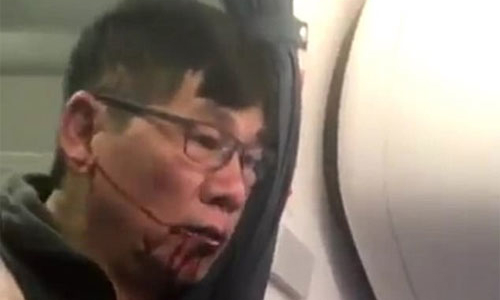 Bác sỹ gốc Việt bị đuổi khỏi máy bay United Airlines thuê hai công ty luật