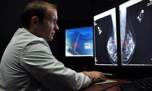 Trí tuệ nhân tạo chẩn đoán chính xác các bệnh ung phổ biến