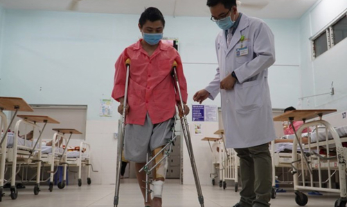 Ghép mảnh titan in 3D thay xương cho bệnh nhân ung thư