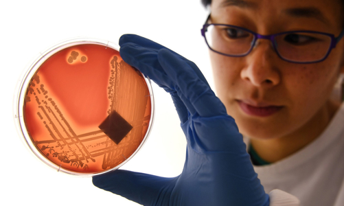 Báo động vi khuẩn E.coli kháng kháng sinh tại Việt Nam