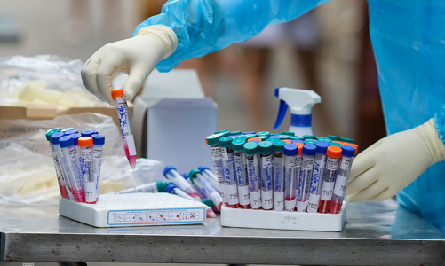 Xác định biến thể SARS-CoV-2 trên bệnh nhân ở Hà Nội, Hải Dương