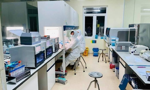 Rà soát lại toàn bộ quy trình thực hiện xét nghiệm SARS-CoV-2 đơn lẻ 