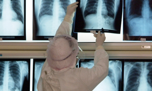 Ứng dụng AI giúp dự báo chính xác bệnh nhân Covid-19 sẽ diễn biến nặng