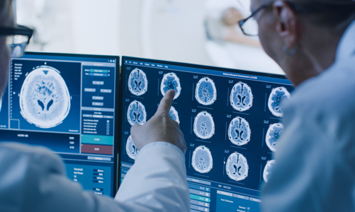 Phát hiện mới: Covid-19 có thể gây tổn hại tới não bộ