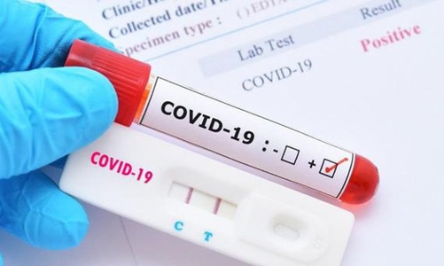 Bộ Công Thương khuyến cáo người tiêu dùng khi mua kit test nhanh kháng nguyên SARS-CoV-2