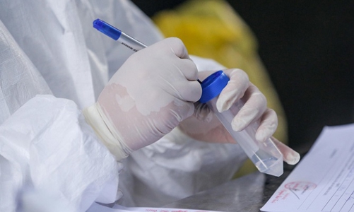 Hà Nội thêm 31 trường hợp dương tính với SARS-CoV-2, 18 ca tại cộng đồng