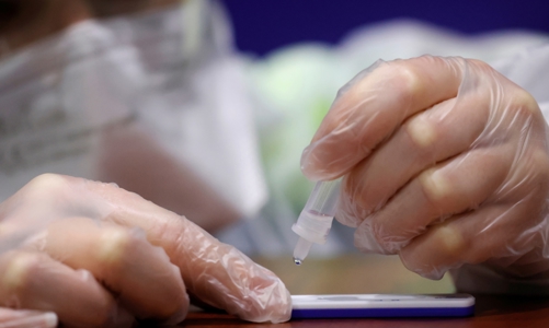 Các chuyên gia lại lo ngại bởi biến chủng nCoV mới: B.1.X