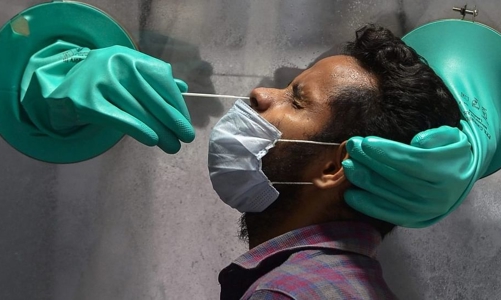 Nghiên cứu: Covid có thể ở lại nhiều tháng trong nội tạng, gây triệu chứng kéo dài