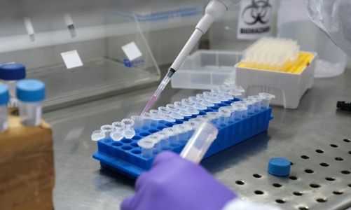 Cyprus phát hiện biến chủng mới kết hợp Omicron và Delta, Nam Phi nói điều lạc quan về đại dịch