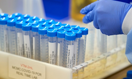 Biến chủng mới BA.2 lây lan nhanh gấp 1,5 lần Omicron