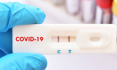 Từ 21/2, giá test nhanh Covid-19 tối đa 78.000 đồng/xét nghiệm