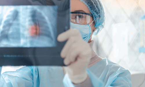 Bất thường ở tiểu phế quản phổi hậu Covid-19