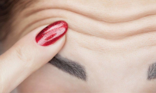 FDA phê duyệt liệu pháp chống nếp nhăn mới, an toàn hơn Botox?