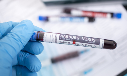 Virus Marburg: Cảnh báo nguy cơ dịch chồng dịch