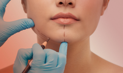 Thận trọng trước xu hướng phẫu thuật “thẩm mỹ đảo ngược”