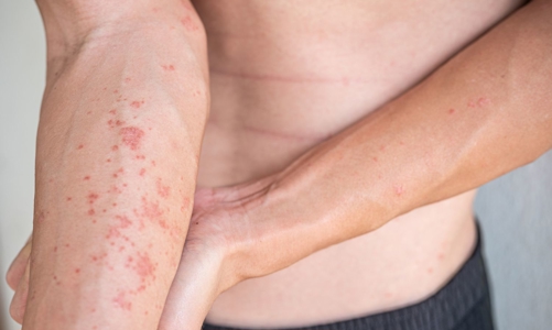 Học cách “lắng nghe