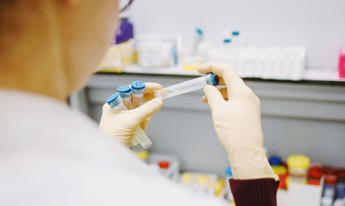 Thế giới trong cuộc đua giảm gánh nặng từ bệnh ung thư