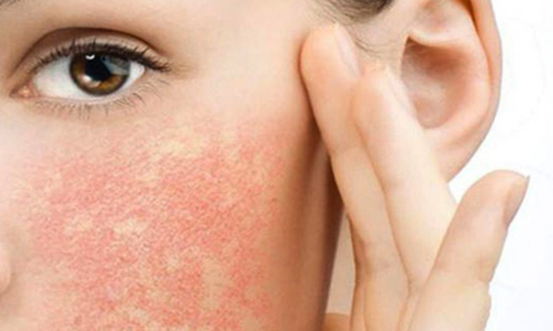 Hè đến, cảnh giác với mỹ phẩm trôi nổi