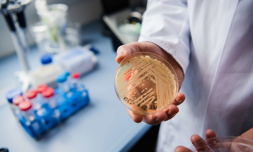 Siêu vi khuẩn, siêu nấm kháng thuốc: Vấn đề y tế cấp bách toàn cầu