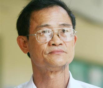 “Đau xót nhưng phải biết chấp nhận”