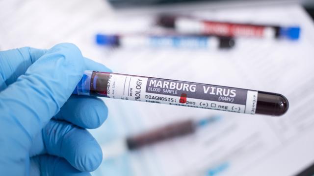 Virus Marburg được xếp vào loại virus nào? 
