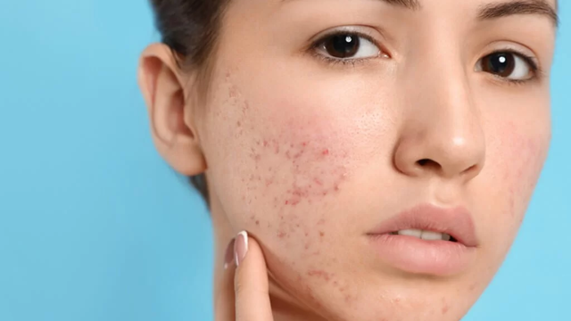 CẢNH BÁO: Thực phẩm chức năng giả tràn lan - Nguy cơ hiểm họa khôn lường cho sức khỏe!
