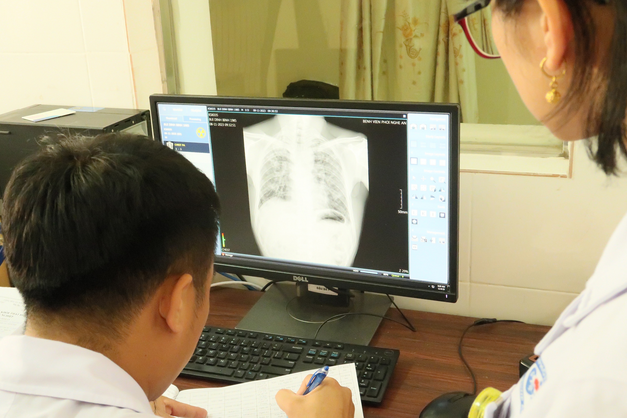Khó khăn lớn nhất khi điều trị tràn khí màng phổi tự phát là bệnh hay tái phát.