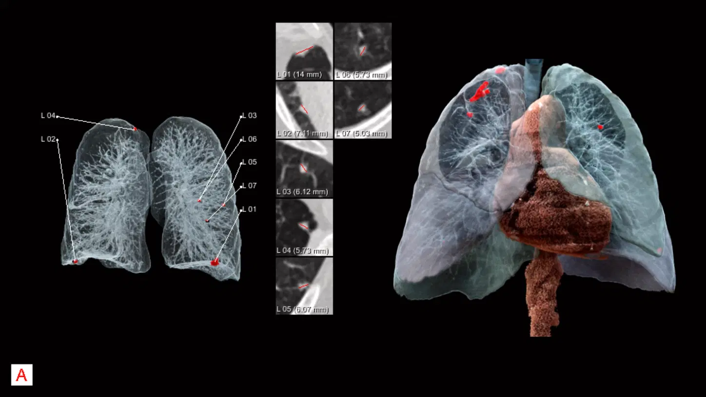 Nhiều bệnh viện đ&atilde; t&iacute;ch cực ứng dụng AI để n&acirc;ng cao chất lượng dịch vụ y tế.