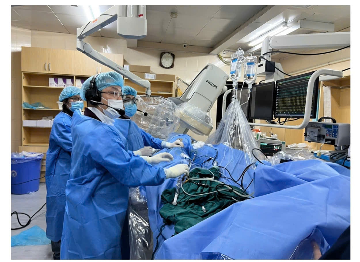 Ca can thiệp triệt đốt rung nhĩ bằng nhiệt lạnh - Cryoablation. 