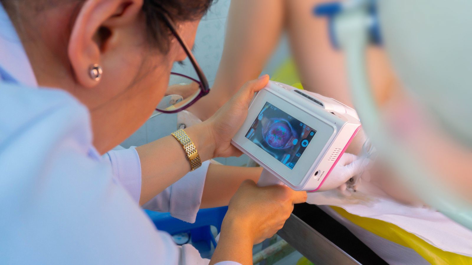 (CerviCare AI tại Bệnh viện H&ugrave;ng Vương.