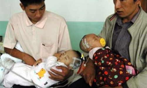 Sữa gây sỏi thận có tại Việt Nam