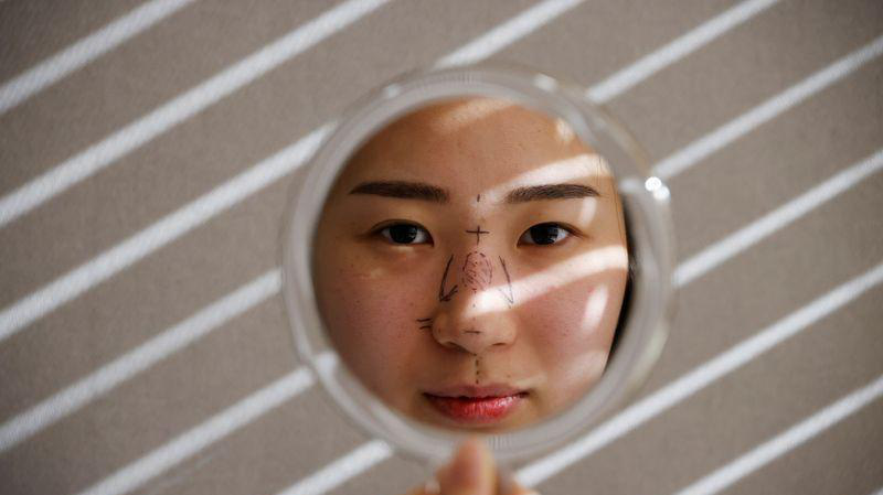 Ryu Han-na trước khi sửa mũi vào tháng 12/2020 - Ảnh: Reuters.