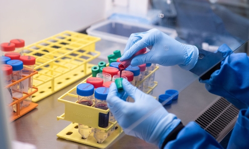 Biến chủng Covid-19 tìm thấy ở Anh có thể gây mất tác dụng vaccine